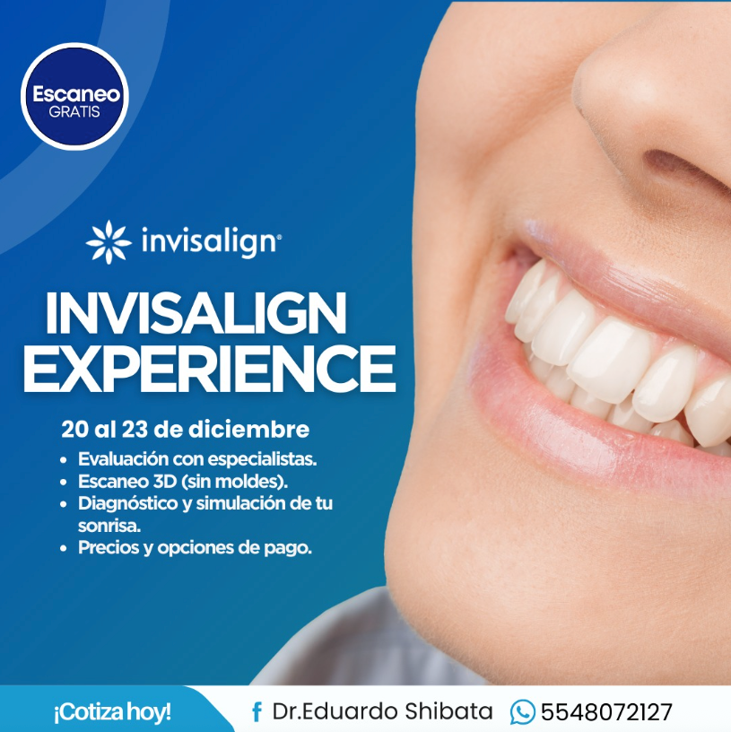 Invisalign Experience